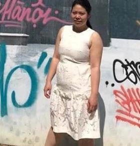 Cô gái Hà Nội giảm 19kg sau khi phẫu thuật thu nhỏ dạ dày