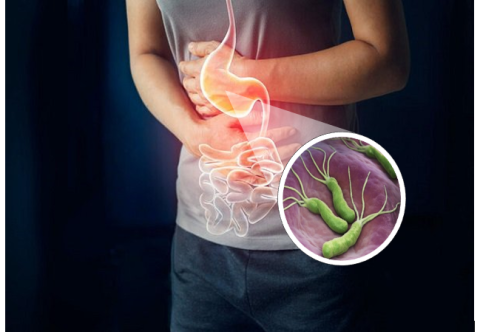 Những ai có nguy cơ mắc ung thư dạ dày và cần tầm soát sớm?