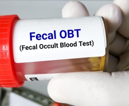 Cần làm gì khi nghi ngờ mắc ung thư đại tràng