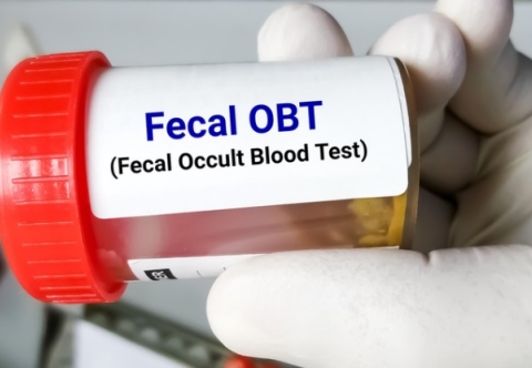 Cần làm gì khi nghi ngờ mắc ung thư đại tràng