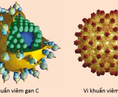 Viêm gan B và viêm gan C có làm tăng nguy cơ ung thư gan không
