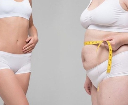 Giảm cân quá nhanh có làm tăng nguy cơ bị sỏi mật không?