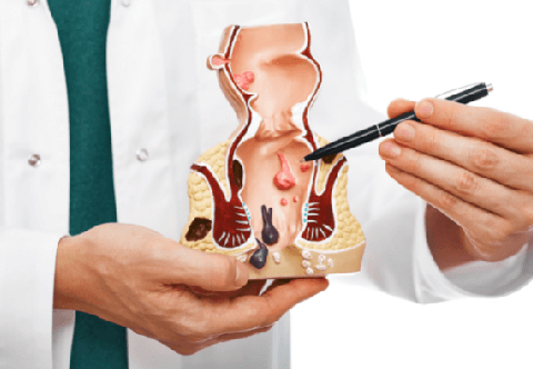 Quy trình khám bệnh trĩ, người bệnh nên biết