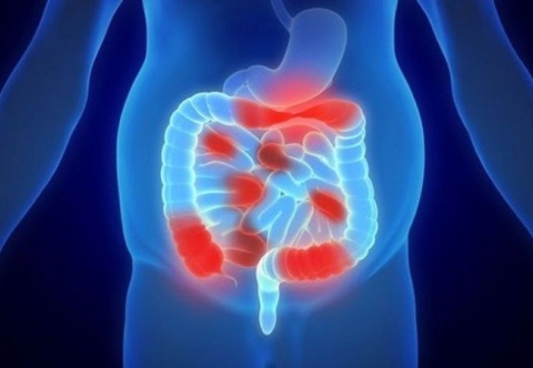 Nguyên nhân nào phổ biến dẫn đến viêm phúc mạc?