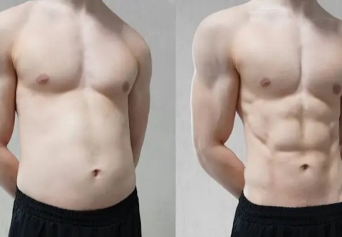 Hậu quả khi kỳ vọng quá cao sau phẫu thuật nội soi thu nhỏ dạ dày là gì?