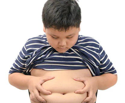 Có nên phẫu thuật thu nhỏ dạ dày điều trị béo phì cho trẻ em
