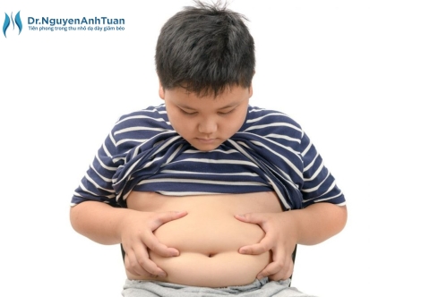 Béo phì ở trẻ em: Hiểu đúng để phòng ngừa và bảo vệ sức khỏe con trẻ