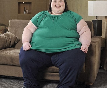 Nguyên nhân khiến bệnh béo phì tăng nhanh trong xã hội hiện đại