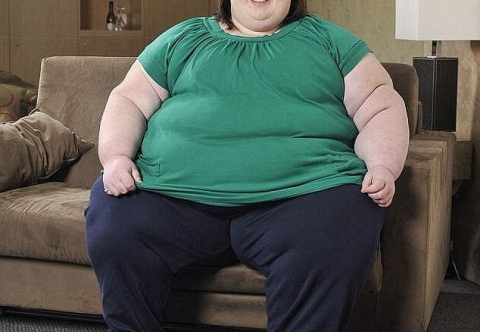 Nguyên nhân khiến bệnh béo phì tăng nhanh trong xã hội hiện đại