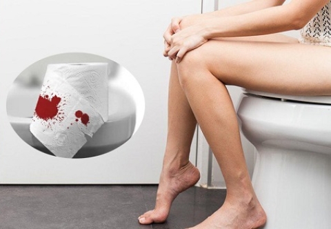 Chảy máu khi đi tiêu là dấu hiệu của bệnh gì