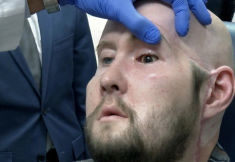 Thử Nghiệm Cấy Ghép Mắt Đầu Tiên Trên Thế Giới