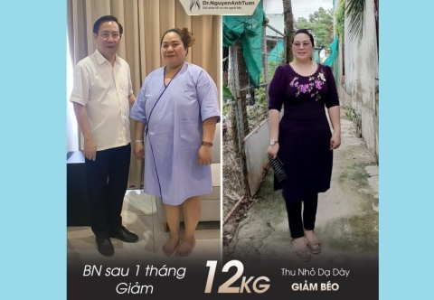 Stress vì căn bệnh béo phì ở lứa tuổi trung niên