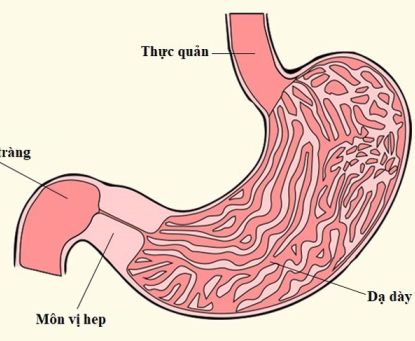 Biến chứng nào xảy ra nếu viêm dạ dày không được điều trị kịp thời