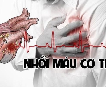 Béo phì và nguy cơ nhồi máu cơ tim