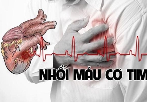Béo phì và nguy cơ nhồi máu cơ tim
