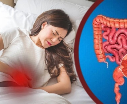 Triệu chứng nhận biết sớm hội chứng ruột kích thích (IBS)