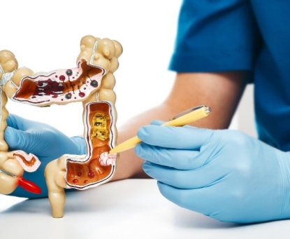 Kết quả điều trị và Tiên lượng của GIST