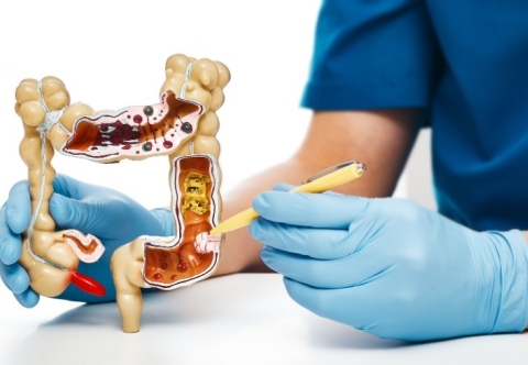 Kết quả điều trị và Tiên lượng của GIST