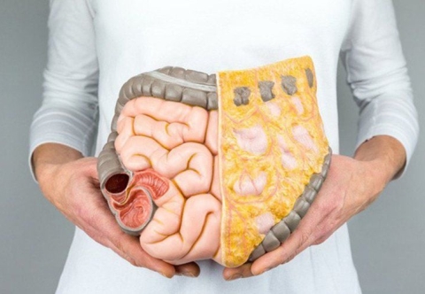 Dư thừa mỡ trắng ảnh hưởng đến cơ thể thế nào?