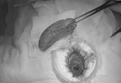 Nhiều người dùng sai tinh bột nghệ trị bệnh