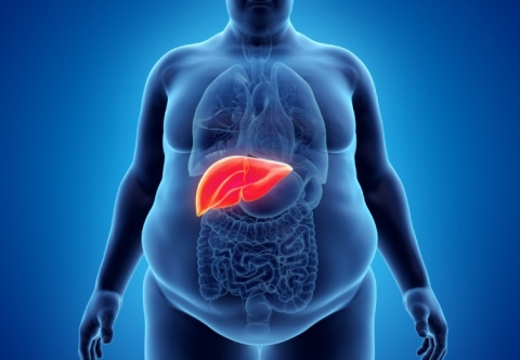 Béo phì gây các bệnh về gan như thế nào