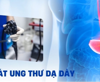 Tầm soát ung thư dạ dày: khi nào và tại sao?