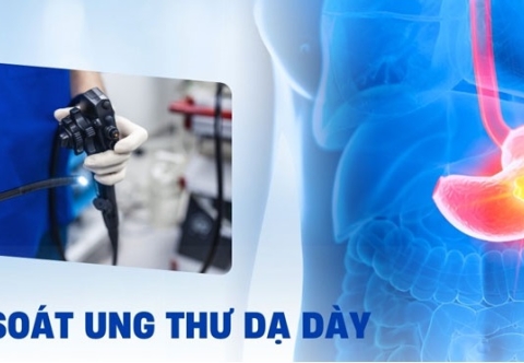 Tầm soát ung thư dạ dày: khi nào và tại sao?