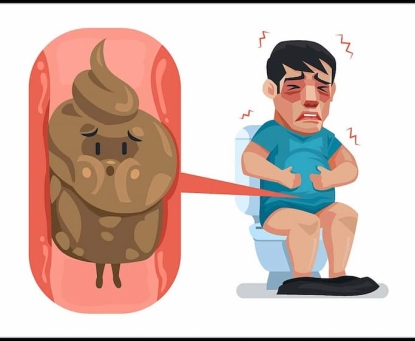 Ngăn ngừa ung thư trực tràng do táo bón