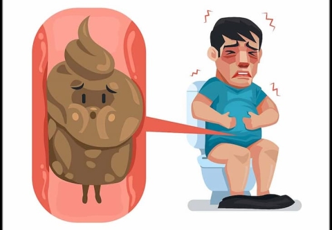 Ngăn ngừa ung thư trực tràng do táo bón