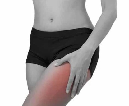 Cảm giác nào ở vùng đùi có thể là dấu hiệu của thoát vị đùi