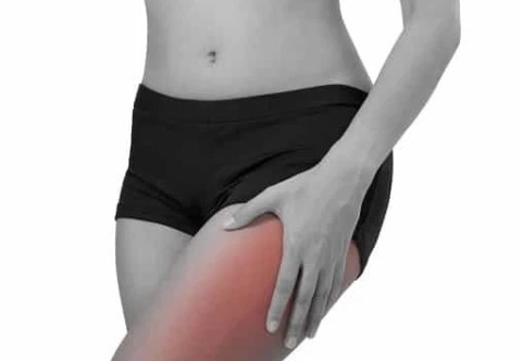 Cảm giác nào ở vùng đùi có thể là dấu hiệu của thoát vị đùi