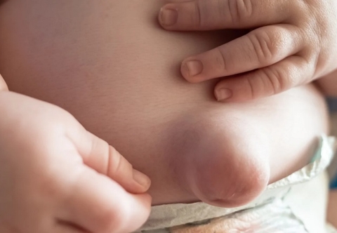 Ngoài thoát vị bẹn, còn có các loại thoát vị thành bụng khác hay không?