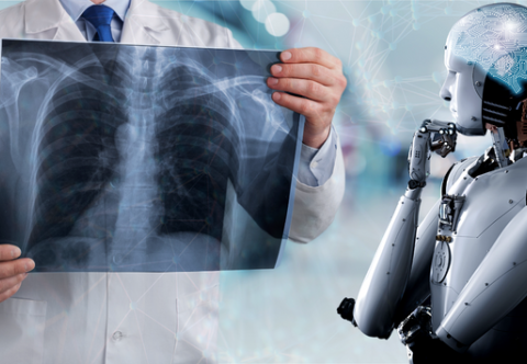 Sàng lọc ung thư phổi bằng trí tuệ nhân tạo (AI)