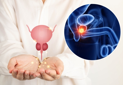 Liệu pháp mới cho ung thư tuyến tiền liệt
