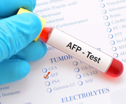 Có những phương pháp nào giúp phát hiện sớm ung thư gan?