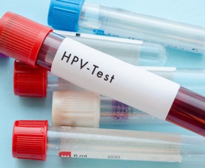 Cách phát hiện sớm ung thư ống hậu môn