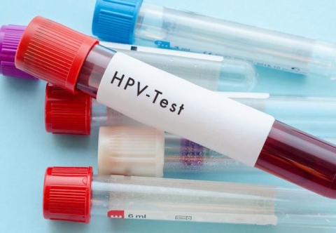 Cách phát hiện sớm ung thư ống hậu môn